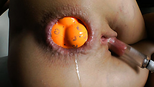 Hole Gapes Shemale Piee - Extreme insertion porn videos